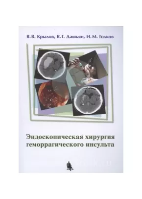 Эндоскопическая хирургия геморрагического инсульта