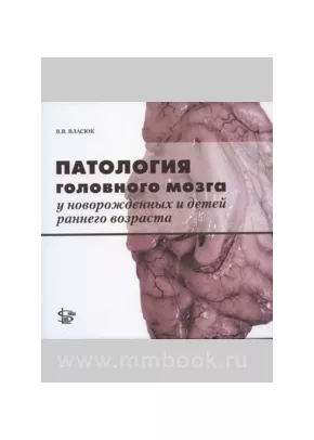 Патология головного мозга у новорожденных и детей раннего возраста