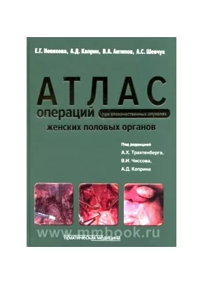 Атлас операций при злокачественных опухолях женских половых органов