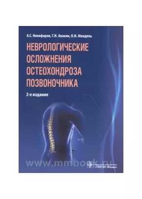 Неврологические осложнения остеохондроза позвоночника