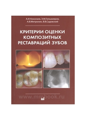 Критерии оценки композитных реставраций зубов
