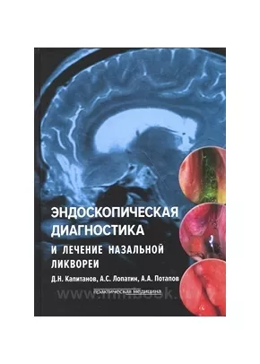 Эндоскопическая диагностика и лечение назальной ликвореи