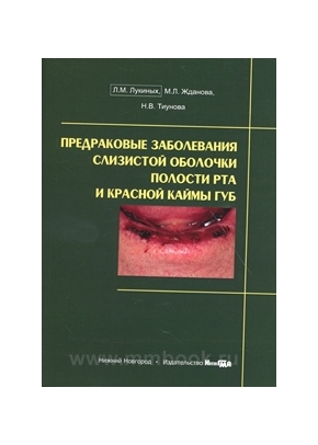 Предраковые заболевания слизистой оболочки полости рта и красной каймы губ