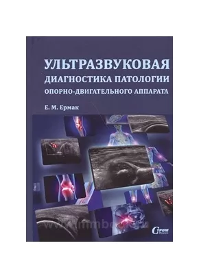 Ультразвуковая диагностика патологии опорно-двигательного аппарата.