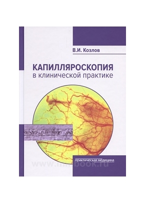 Капилляроскопия в клинической практике