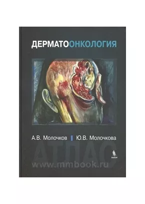 Дерматоонкология. Атлас