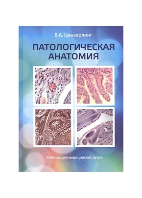 Патологическая анатомия: Учебник для медицинских вузов