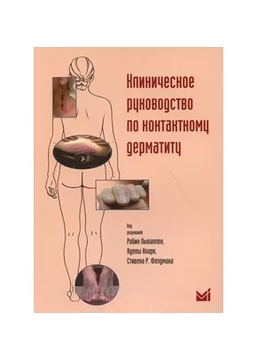 Клиническое руководство по контактному дерматиту