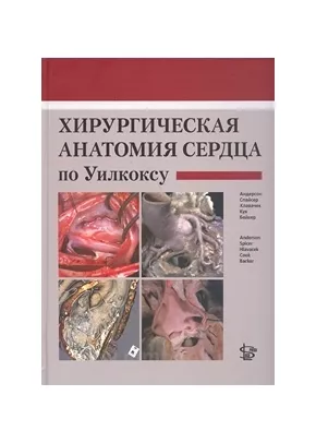 Хирургическая анатомия сердца по Уилкоксу