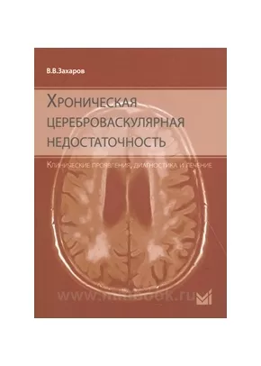 Хроническая цереброваскулярная недостаточность