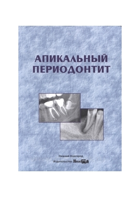 Апикальный периодонтит: учебное пособие