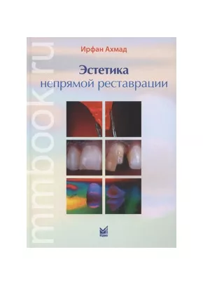 Эстетика непрямой реставрации