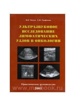 Ультразвуковое исследование лимфатических узлов в онкологии