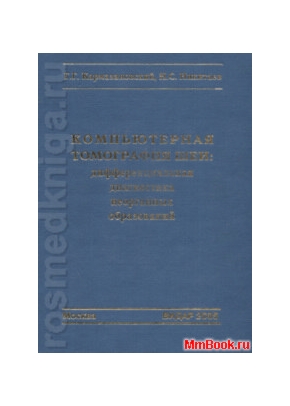 Компьютерная томография шеи: дифференциальная диагностика неорганных образований