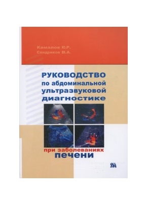 Руководство по абдоминальной ультразвуковой диагностике при заболеваниях печени