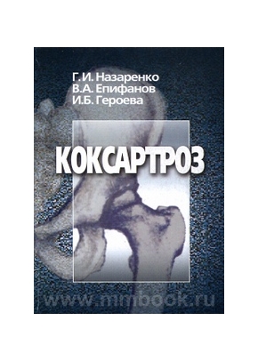 Коксартроз