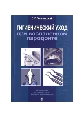 Гигиенический уход при воспаленном пародонте