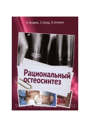 Рациональный остеосинтез