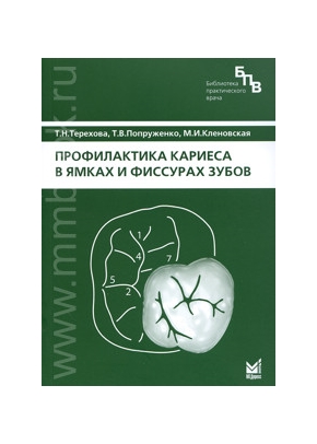 Профилактика кариеса в ямках и фиссурах зубов