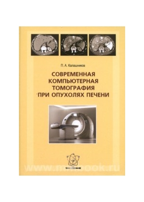 Современная компьютерная томография при опухолях печени