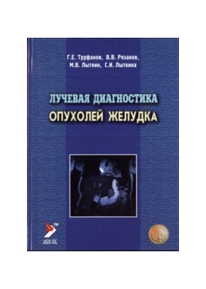 Лучевая диагностика опухолей желудка