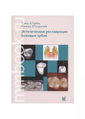 Эстетическая реставрация боковых зубов