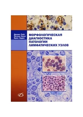 Морфологическая диагностика патологии лимфатических узлов