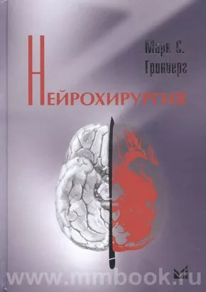 Нейрохирургия