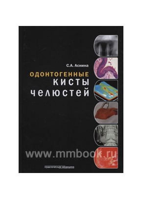 Одонтогенные кисты челюстей