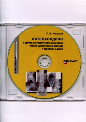 CD-ROM: Остеохондроз и другие дистрофические изменения опорно-двигательной системы у взрослых и детей