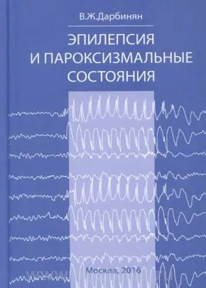 Эпилепсия и пароксизмальные состояния. Клиника, диагностика, лечение