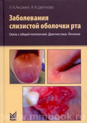 Заболевания слизистой оболочки рта. Связь с общей патологией. Диагностика. Лечение