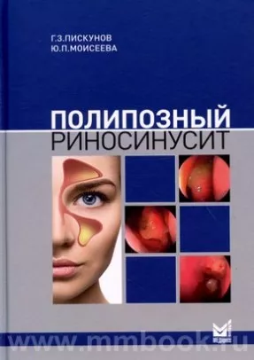 Полипозный риносинусит