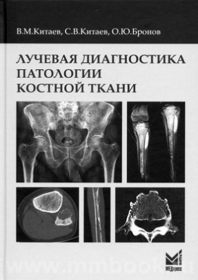 Китаев В.М. - Лучевая диагностика патологии костной ткани