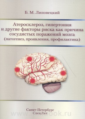 Липовецкий Б.М. - Атеросклероз, гипертония и другие факторы риска как причина сосудистых поражений мозга