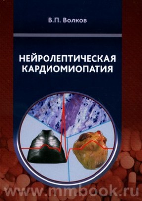 Волков В. П. - Нейролептическая кардиомиопатия