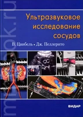 Ультразвуковое исследование сосудов