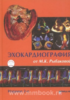 Эхокардиография от Рыбаковой с DVD 2-е издание
