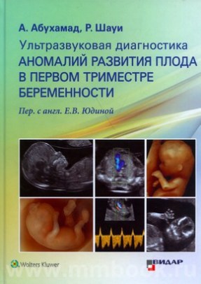 Ультразвуковая диагностика аномалий развития плода в первом триместре беременности