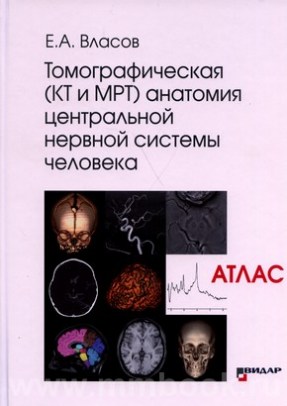 Томографическая (КТ и МРТ) анатомия центральной нервной системы человека [Атлас]