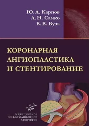 Коронарная ангиопластика и стентирование