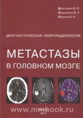 Диагностическая нейрорадиология. Метастазы в головном мозге