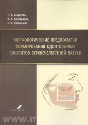 Морфологические предпосылки формирования одонтогенных синуситов верхнечелюстной пазухи
