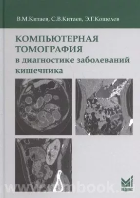 Компьютерная томография в диагностике заболеваний кишечника