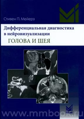 Дифференциальная диагностика в нейровизуализации. Голова и шея