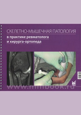 Скелетно-мышечная патология в практике ревматолога и хирурга-ортопеда