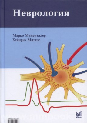 Неврология