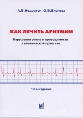 Как лечить аритмии. Нарушения ритма и проводимости в клинической