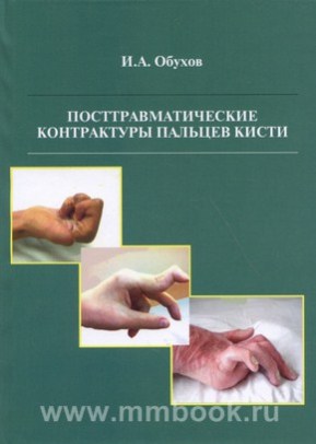 Кистевая хирургия: Посттравматические контрактуры пальцев кисти