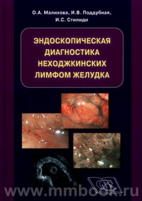 Эндоскопическая диагностика неходжкинских лимфом желудка